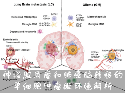 【烈冰助力】神經(jīng)膠質瘤和肺癌腦轉移的單細胞腫瘤微環(huán)境解析